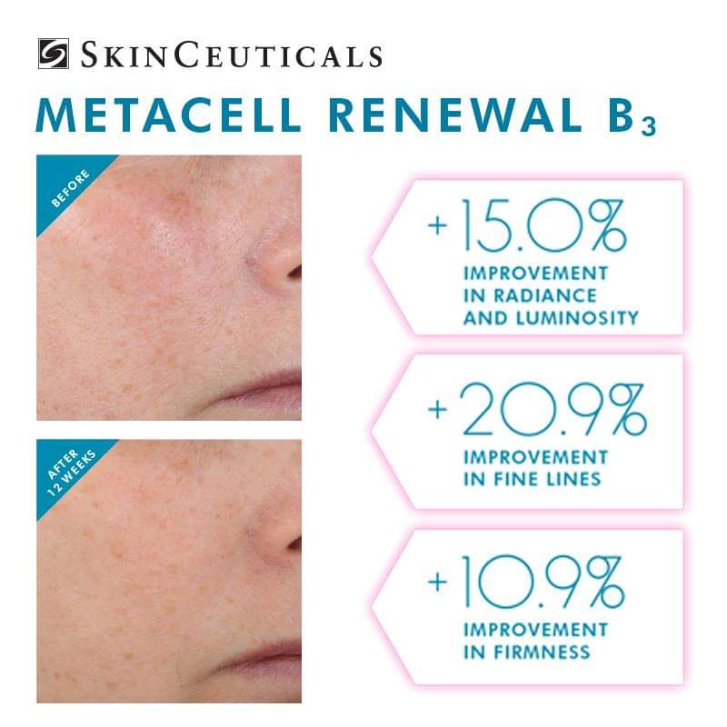 SKINCEUTICALS METACELL RENEWAL B3 *Low Stock* - Exquisite Laser Clinic