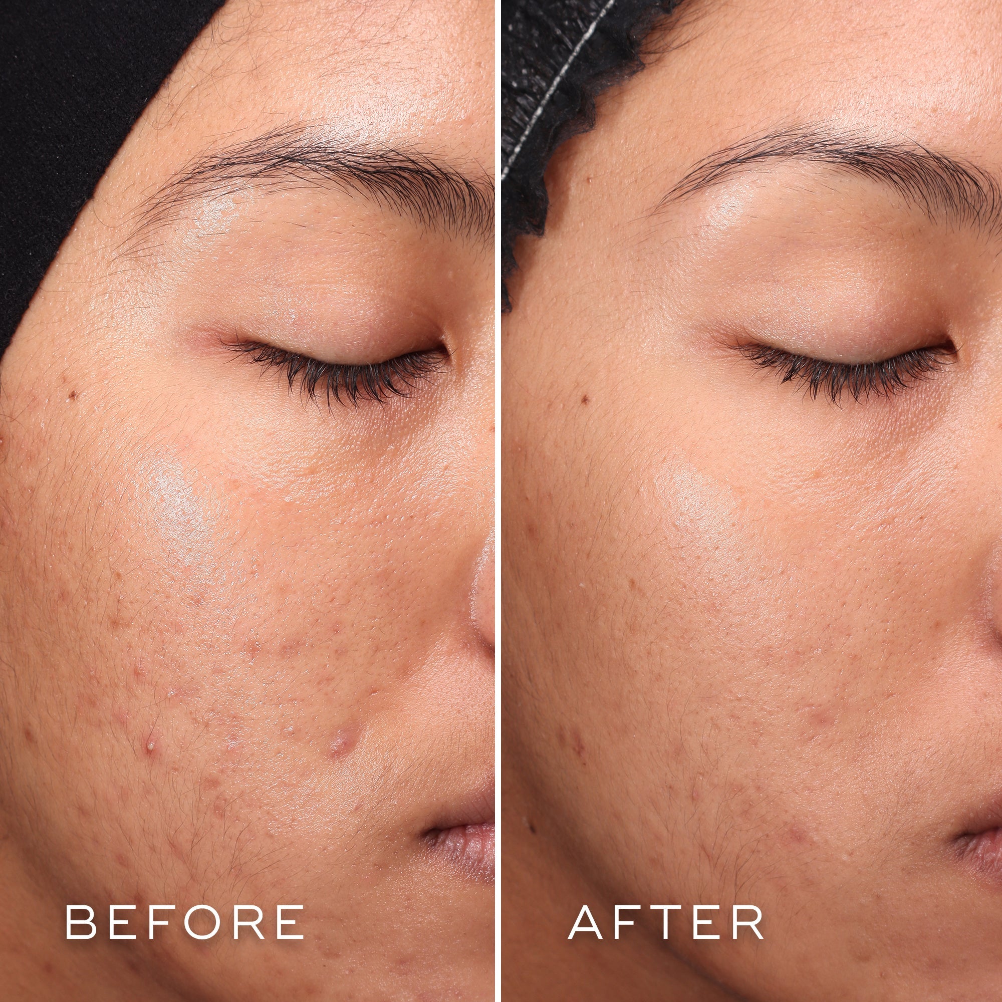 Medik8 Press & Clear Refill - Exquisite Laser Clinic 