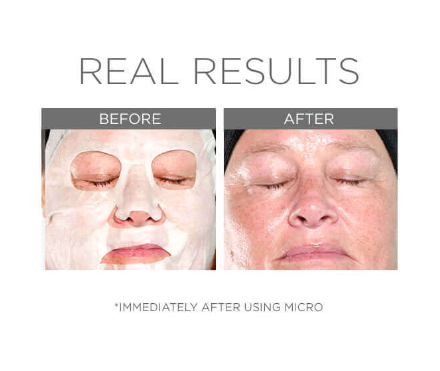 COSMEDIX Micro Defense Sheet Mask - Exquisite Laser Clinic 