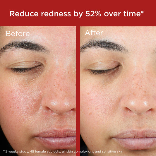 Elta MD sunscreen EltaMD UV Skin Recovery Broad Spectrum SPF 50 Face Sunscreen - Untinted