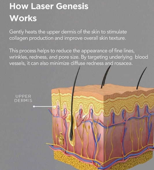 Exquisite Laser Clinic  skin treatment Laser Genesis Skin Rejuvenation Full Face