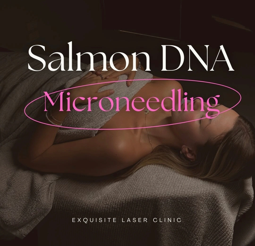 Exquisite Laser Clinic treatment Microneedling Salmon DNA PDRN Treatment Full Face