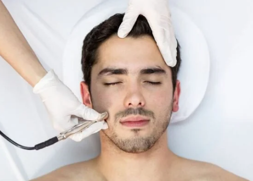Microdermabrasion Treatment ✨️ 50% OFF Sale ✨️