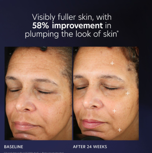 PCA Skincare skincare PCA Pro Max Age Renewal