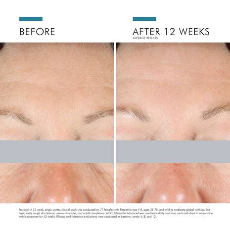 skinceuticals moisturiser Skinceuticals AGE Interrupter Advanced **Pre Order**
