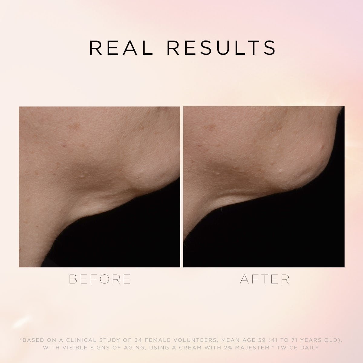 Cosmedix Illuminate & Lift Neck & Decollete - Exquisite Laser Clinic