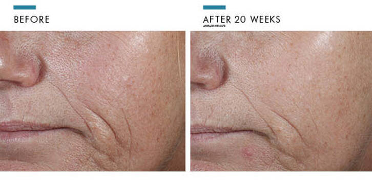 SKINCEUTICALS CE FERULIC 30ml - Exquisite Laser Clinic