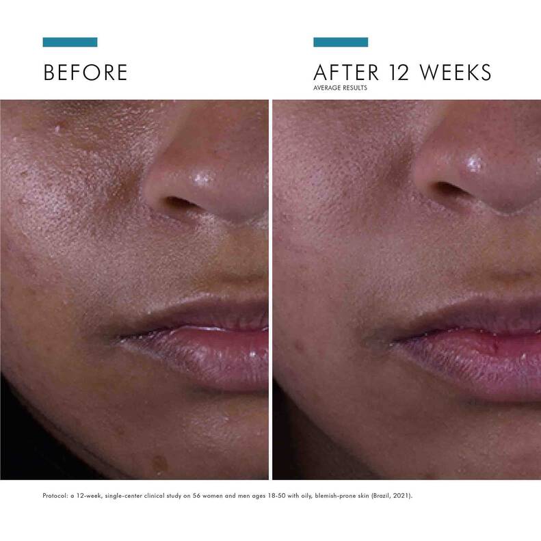 Skinceuticals Silymarin CF - Exquisite Laser Clinic