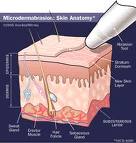 treatment skincare Triple Treat Package  - Microdermabrasion / Laser Genesis / Dermafrac